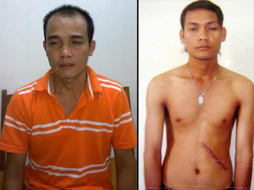 Phá đường dây bán thận quy mô lớn sang Trung Quốc  - 1