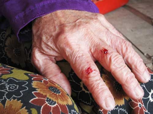 Một giáo viên ngược đãi bố mẹ chồng  - 2 Một giáo viên ngược đãi bố mẹ chồng  - 2