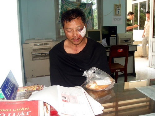 Kẻ cướp tiệm vàng ở Bình Thuận là Việt kiều Mỹ - 1 Kẻ cướp tiệm vàng ở Bình Thuận là Việt kiều Mỹ - 1