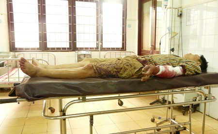 Anh Trần Tuấn Anh (SN 1986) đang cấp cứu tại Bệnh viện Đa khoa tỉnh Đắk Lắk, sáng 20/3.