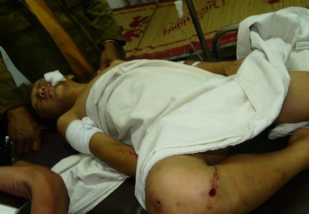 Nổ mìn, 1 học sinh tử vong, 6 học sinh trọng thương