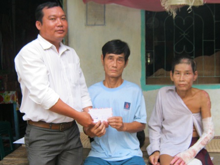 Hơn 18 triệu đồng đến với người anh câm, điếc nuôi em bị bỏng - 1