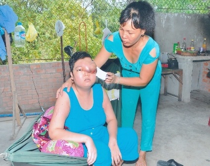 Đau lòng nhìn mắt thiếu nữ sắp nổ tung - 1 Đau lòng nhìn mắt thiếu nữ sắp nổ tung