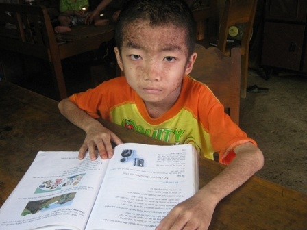 Dù bềnh tật vất kiệt sức nhưng trong 4 năm liền cháu Hợp luôn đạt danh hiệu học sinh giỏi