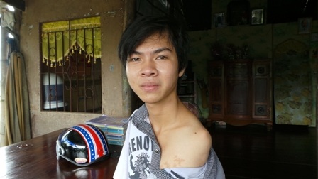 Lúc sinh ra, Trí đã không có 2 cánh tay như các em bé khác.