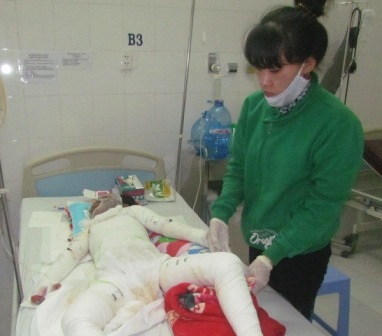 Cháu Như Thuỷ bị bỏng toàn thân, hiện sức khoẻ rất nguy kịch