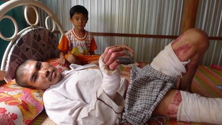 Trao hơn 72 triệu đồng đến anh Nguyễn Văn Nhí - 1 Hai tay anh Nhí bị ro rút nên anh chưa để thẳng hai tay xuống giường được