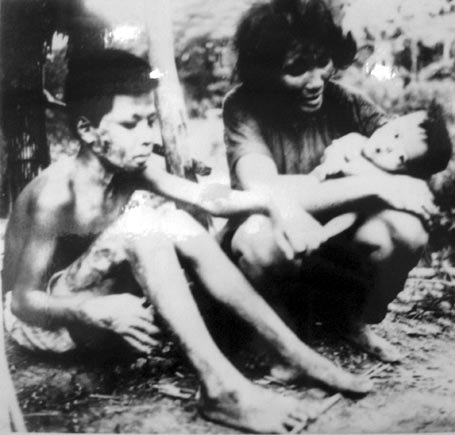 50 năm thảm họa da cam Việt Nam - 4 50 năm thảm họa da cam Việt Nam - 4