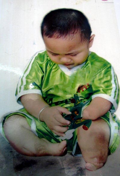 50 năm thảm họa da cam Việt Nam - 7 50 năm thảm họa da cam Việt Nam - 7