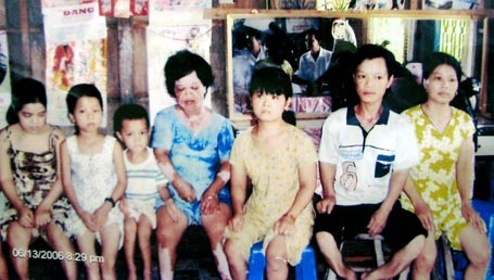 50 năm thảm họa da cam Việt Nam - 8 50 năm thảm họa da cam Việt Nam - 8