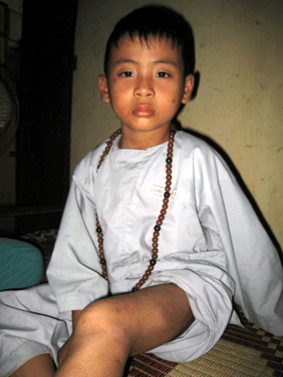 Trụ trì chùa đánh đập dã man trẻ mồ côi - 1