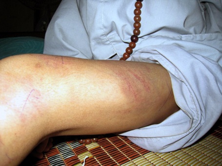 Trụ trì chùa đánh đập dã man trẻ mồ côi - 2