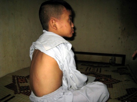 Trụ trì chùa đánh đập dã man trẻ mồ côi - 3