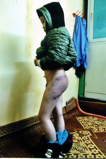 Vụ bé lớp 3 bị đánh: Mẹ kế thừa nhận đã đánh con - 1