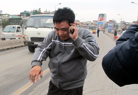 Hà Nội: Xe Mercedes bốc cháy trên cầu Chương Dương - 3 Hà Nội: Xe Mercedes bốc cháy trên cầu Chương Dương - 3