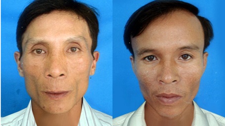 Mang quả bom gần 100 kg đi bán - 1 Đối tượng Tâm và Nhiên