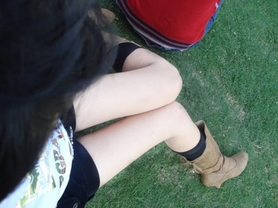 Bác sỹ giải mã hiện tượng “khoe hàng” - 1 Bác sỹ giải mã hiện tượng “khoe hàng” - 1