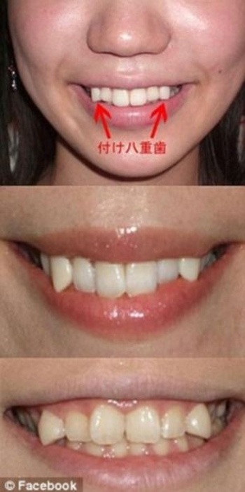 Nhật Bản: Thiếu nữ rộ mốt làm đẹp... răng ma cà rồng - 5 Theo