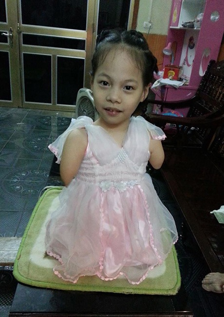 Em bé không tay chân mong gặp Vujicic gây xúc động dân mạng - 1 Bé Linh Chi