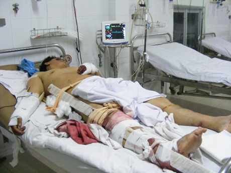 Vụ tai nạn 7 người chết qua lời kể nạn nhân sống sót - 2 Nạn nhân vụ tai nạn đang được điều trị tại Bệnh viện Đa khoa Bình Thuận.