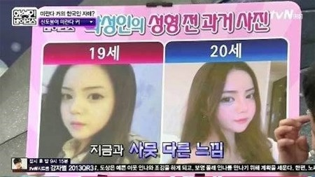 Và cô quyết định phẫu thuật để có được khuôn mặt giống siêu mẫu Úc