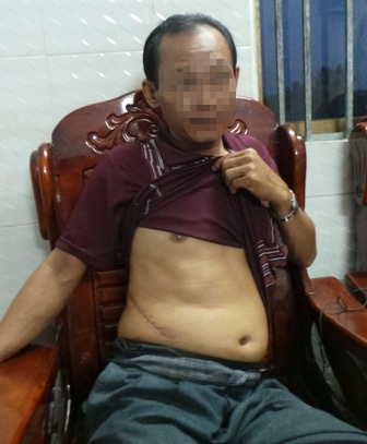 Rủ nhau bán thận… để thoát nghèo? - 2 Anh Hồ Văn Tranh, một trong những trường hợp hiến thận tiếp xúc với PV chiều 4/4 (ảnh Phạm Tâm)