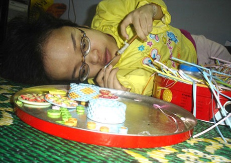Cô gái xương thủy tinh "gieo" hi vọng cho người khuyết tật - 1 Nguyễn Thị Thu Thương