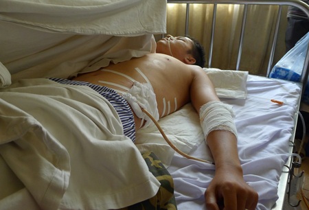 TAND quận Hà Đông đang hoàn tất thủ tục đưa vụ án đâm chém dã man