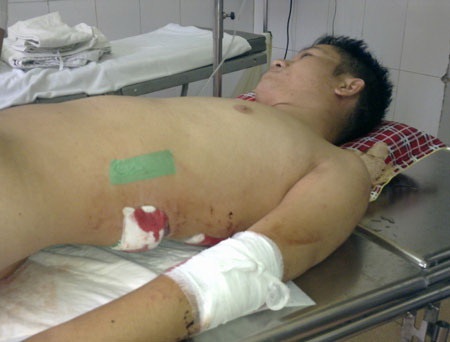 Anh Đức Dũng từng trải qua giây phút thập tử nhất sinh