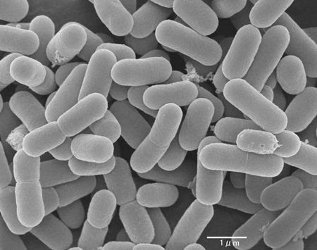 Bổ sung lợi khuẩn Probiotics mỗi ngày giúp giảm thiểu cholesterol hiệu quả - 1 Vi lợi khuẩn Lactobacillus reuteri