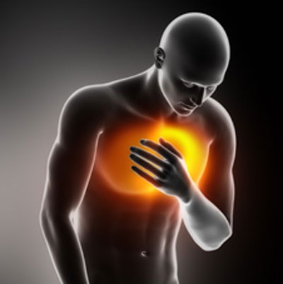 Ai dễ bị nhồi máu cơ tim? - 1 Ai dễ bị nhồi máu cơ tim?