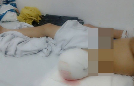 Lái xe gây tai nạn thờ ơ, nạn nhân rơi vào cảnh khốn đốn - 3 Việc lái xe bus và doanh nghiệp thờ ơ đang đẩy gia đình cháu Định vào hoàn cảnh điêu đứng