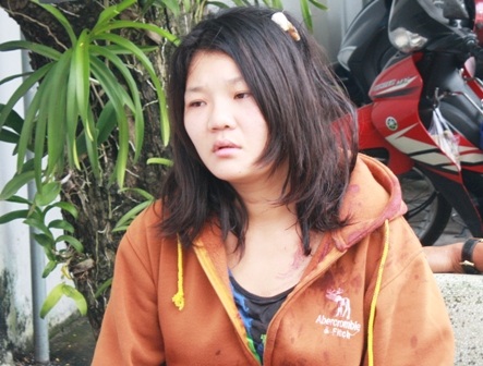 Giải cứu người phụ nữ bị trói, đánh đập dã man - 1 Chị Vy Thị Xuân Hạnh với vết thương trên đầu