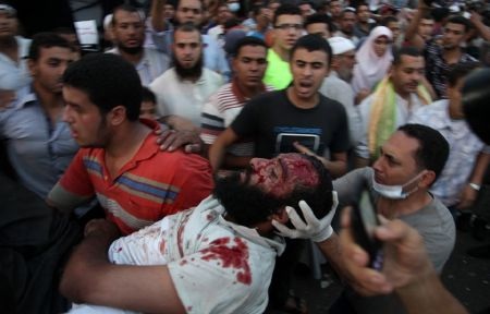Rất nhiều người Ai Cập bị thương sau các cuộc đụng độ
