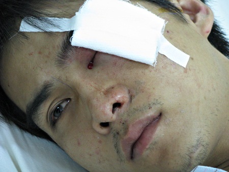 Hai thí sinh tố bị nhân viên giữ xe đánh rách khóe mắt - 3