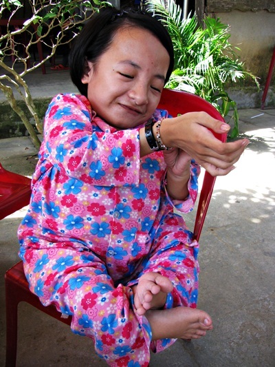 Nghị lực của thí sinh cao 70cm - 1