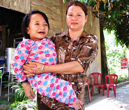 Nghị lực của thí sinh cao 70cm - 3