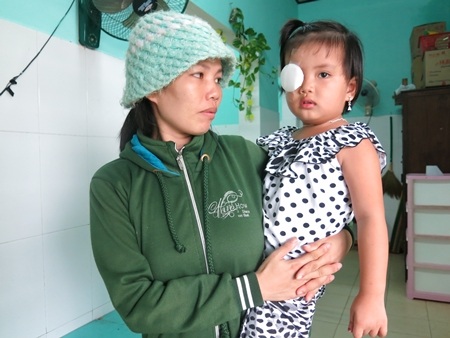 Xót lòng cháu bé 3 tuổi đã phải phẫu thuật cắt bỏ mắt