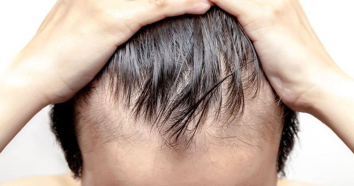 Những “thủ phạm” gây rụng tóc nhiều ở nữ và cách khắc phục
