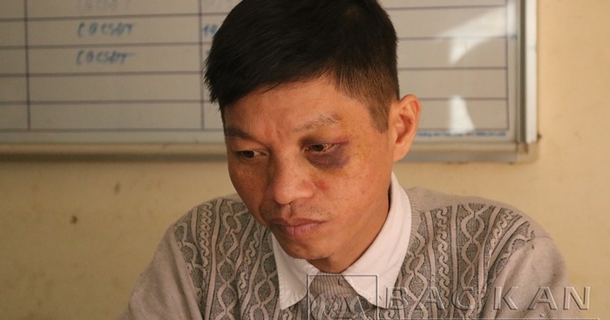 Khởi tố nam thanh niên đi xe máy tông thẳng vào cảnh sát giao …