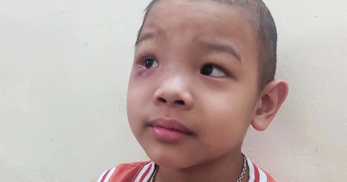 Cậu bé 7 tuổi "tái ung thư": Mẹ vào thuốc... con mới sống được - Vimarsana News