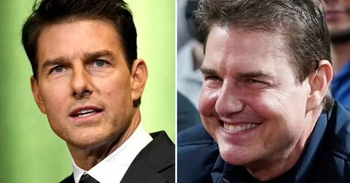 Total 95+ imagen tom cruise botox - fr.thptnganamst.edu.vn