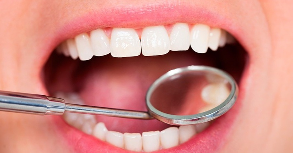 Ung thư nướu răng: Dấu hiệu và cách phòng bệnh | Báo Dân trí