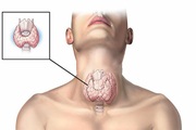 Ung thư tuyến giáp có chữa khỏi được không?