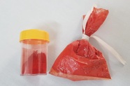Ăn sốt vang nấu với phụ gia có hóa chất nhuộm tóc, 2 người ngộ độc