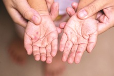 Không chủ quan với bệnh sởi