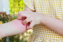 Sợ hãi khi trẻ bị nhiễm giun đũa chó mèo dù chưa bao giờ nuôi thú cưng