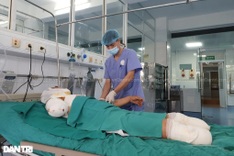 Severely-burnt man in Nghe An seeks help