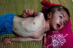 Mother struggles to provide daily meals to small children