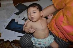 VND140m to little girl with multiple diseases